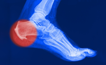 Рентгенография